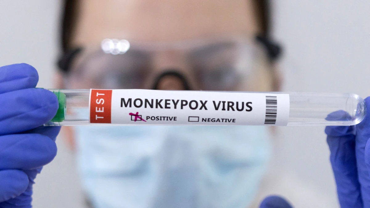 Потврден уште еден случај на мајмунски сипаници во Словенија