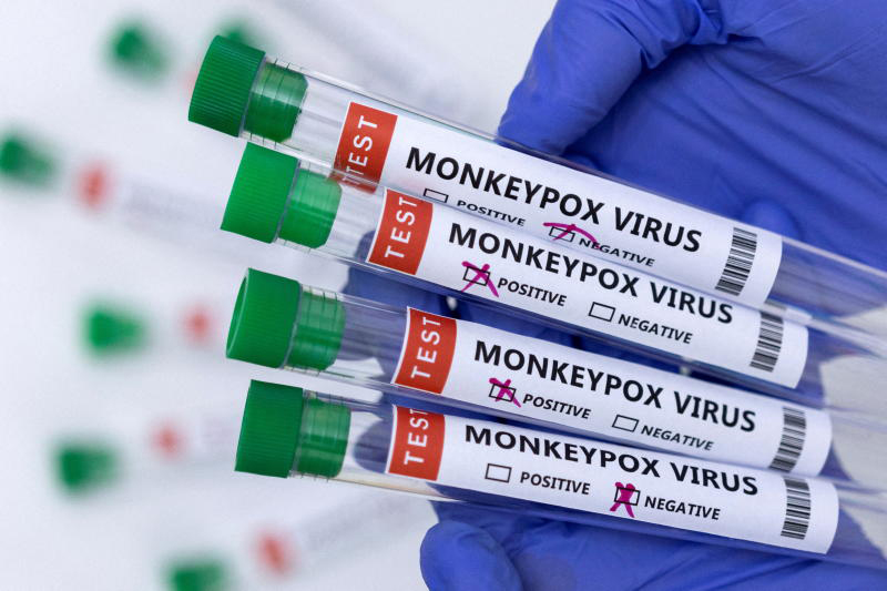 Потврден првиот случај на мајмунска сипаница во Хрватска