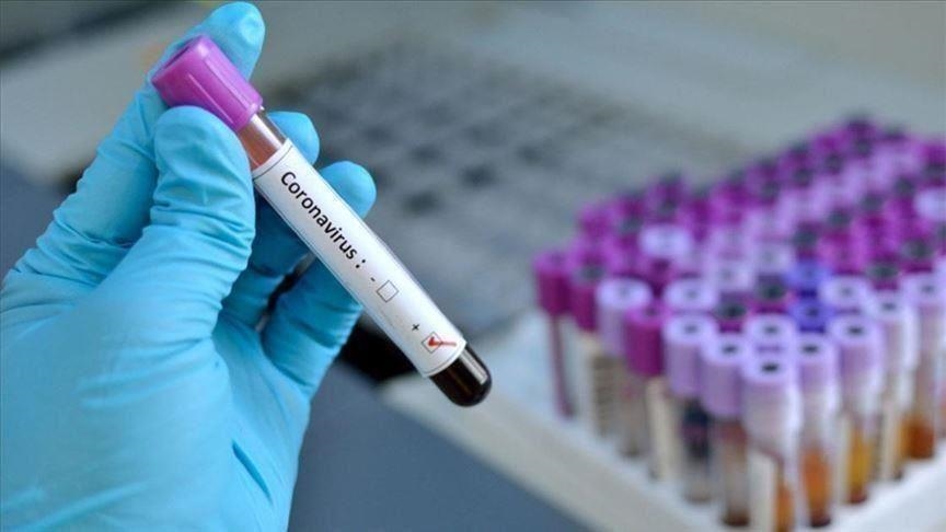 Расте бројот на заразени од Ковид-19, пријавени две починати лица