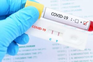 Нови 134 случаи на коронавирус, вкупно три лица починаа