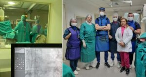 Во струмичката болница почна да се работи стентирање на вратна артерија – направена првата интервенција !